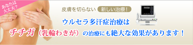 ウルセラ多汗症治療はチチガ（乳輪わきが）の治療にも絶大な効果があります！