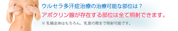 ウルセラ多汗症治療の治療可能な部位は？アポクリン腺が存在する部位は全て照射できます。※乳輪全体はもちろん、乳首の際まで照射可能です。